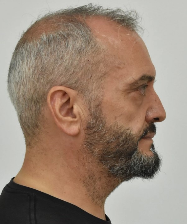 Κολωνός: Αυτοί είναι οι δύο συλληφθέντες που κατηγορούνται για τον βιασμό της 12χρονης