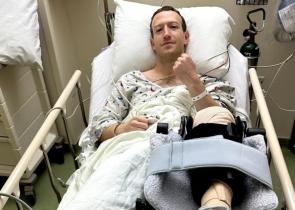 Μαρκ Ζούκερμπεργκ: Στο χειρουργείο μετά από προπόνηση που έκανε για αγώνες MMA
