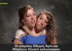 ΗΠΑ: Οι πιο διάσημες σιαμαίες ονειρεύονται να αποκτήσουν παιδιά