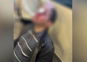 Επίθεση στη Νομική: Σαρώνουν τις κάμερες ασφαλείας για να εντοπίσουν τους δράστες - Τι εξετάζει η αστυνομία